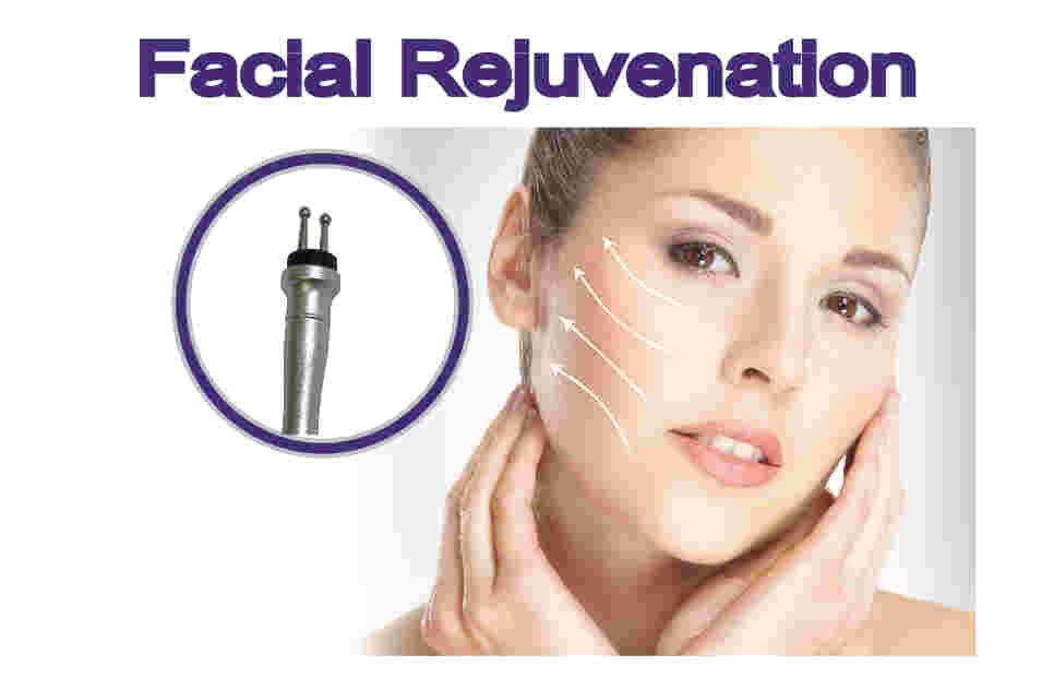 Improve light sagging skin of the face and neck