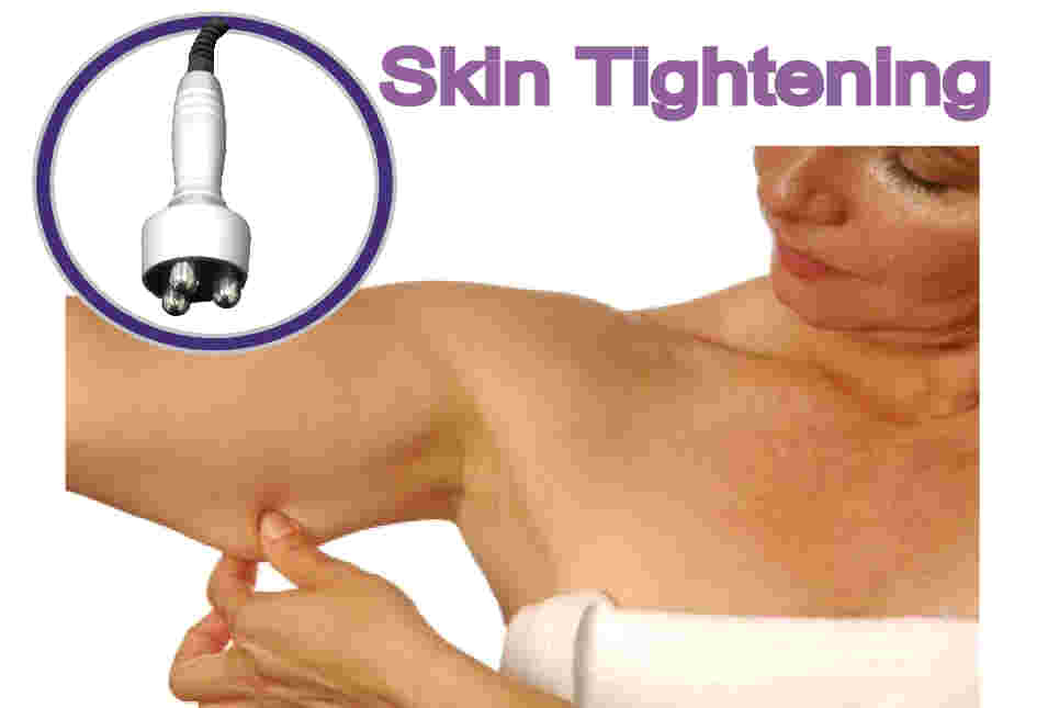 skin tightening machine